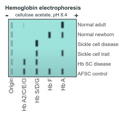 hemoglobin content is assessed in the laboratory by analyzing|hemoglobin electrophoresis vs fractionation.